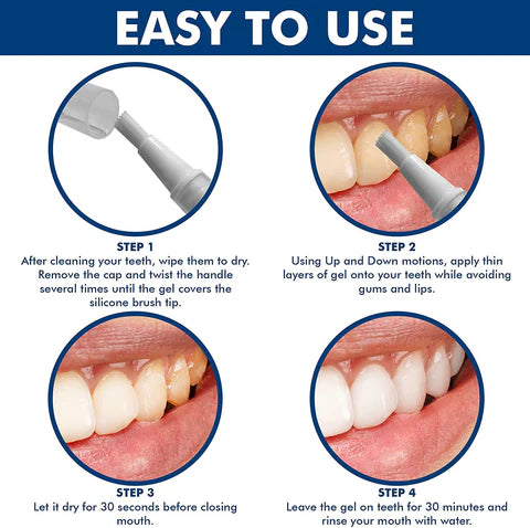 Dazzle Instant Teeth Whitening Pen