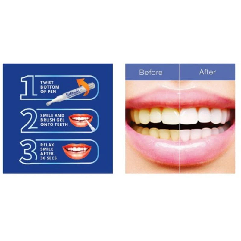 Dazzle Instant Teeth Whitening Pen